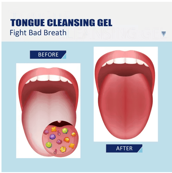 Oral Hygiene Gel for Tongue with Tongue Cleaner - Sywora