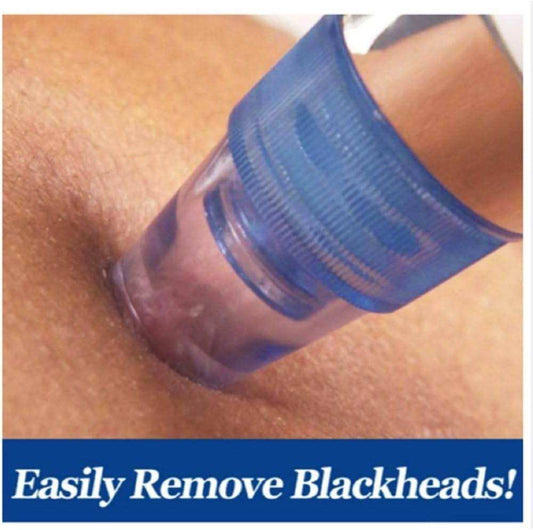 Blackhead Remover Vacuum Device for Clear Skin - Sywora